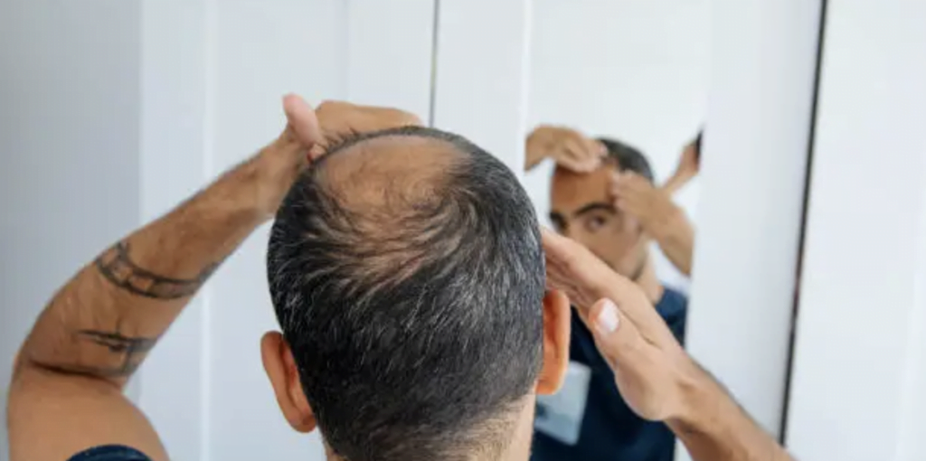 維生素B7—生物素的缺乏會導致掉髮與肌膚狀況惡化等問題，不可忽略！