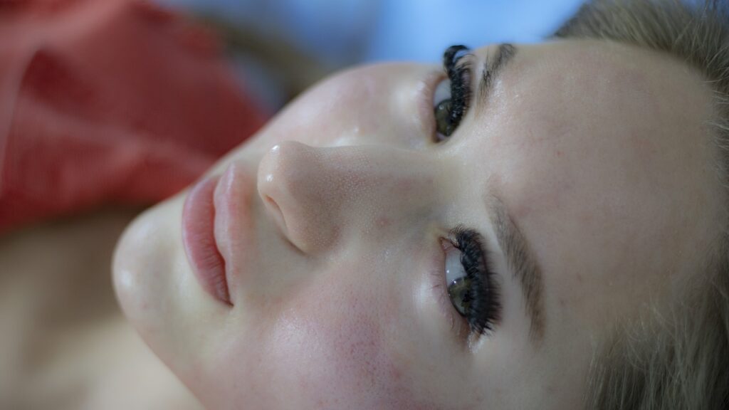 A酸在使用後有些人會有皮膚泛紅的現象,因此要定期回診追蹤