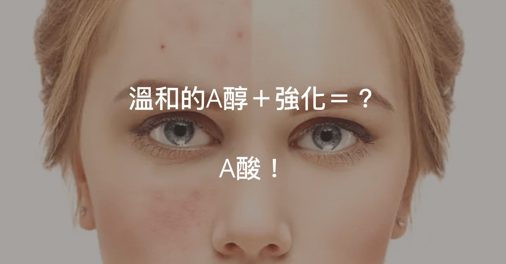 上一篇文提到了溫和有效的A醇，本文就接著介紹強化版本的A酸！